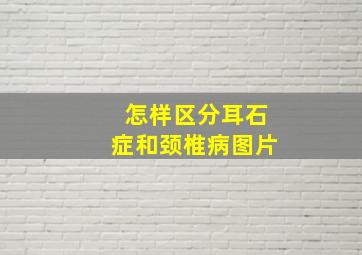 怎样区分耳石症和颈椎病图片