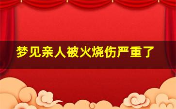 梦见亲人被火烧伤严重了