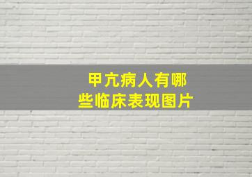 甲亢病人有哪些临床表现图片