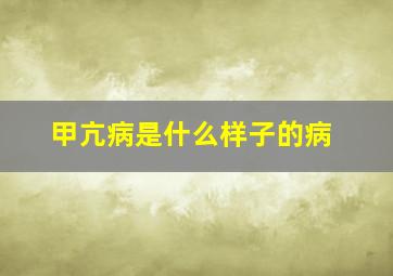 甲亢病是什么样子的病