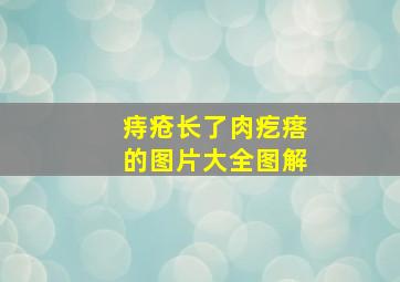 痔疮长了肉疙瘩的图片大全图解