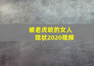 被老虎咬的女人现状2020视频