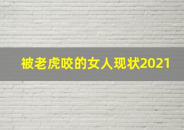 被老虎咬的女人现状2021